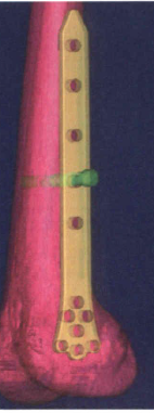 2.PNG