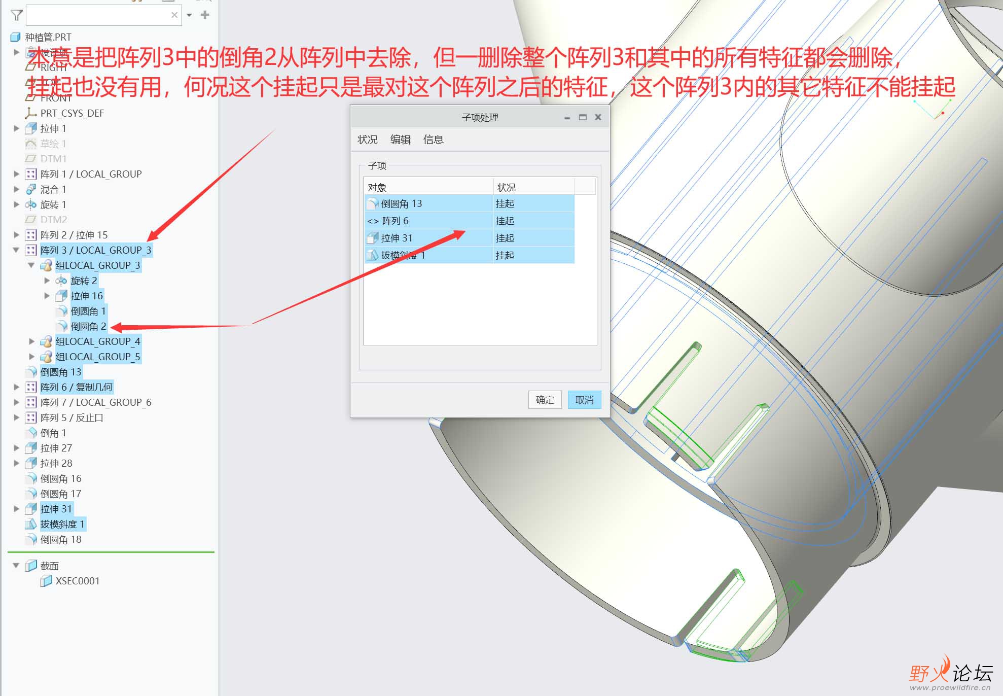 挂起回复.jpg