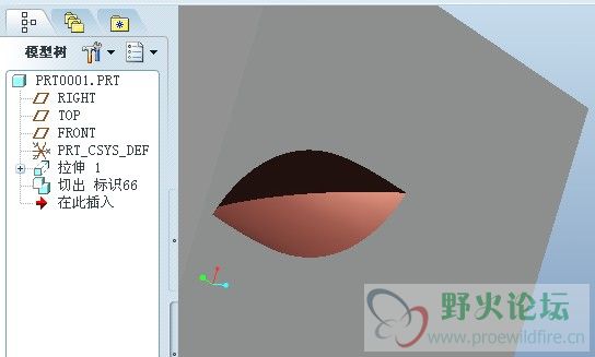 切除后的效果.jpg